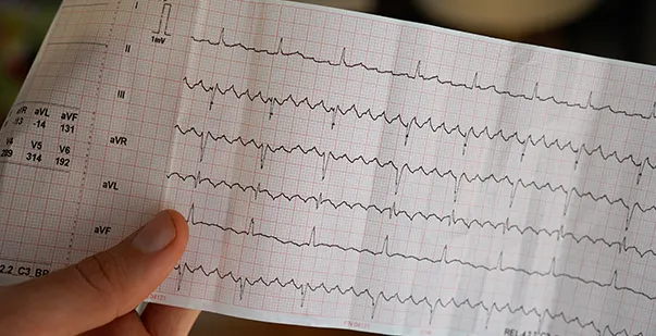 Afib vs. Vfib similarities, differences & treatment post img